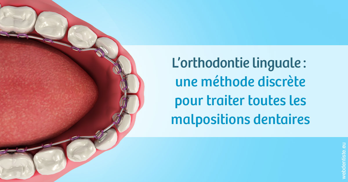 https://dr-david-mailhes.chirurgiens-dentistes.fr/L'orthodontie linguale 1
