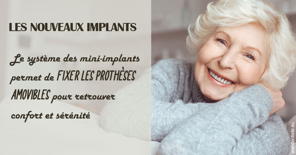 https://dr-david-mailhes.chirurgiens-dentistes.fr/Les nouveaux implants 1