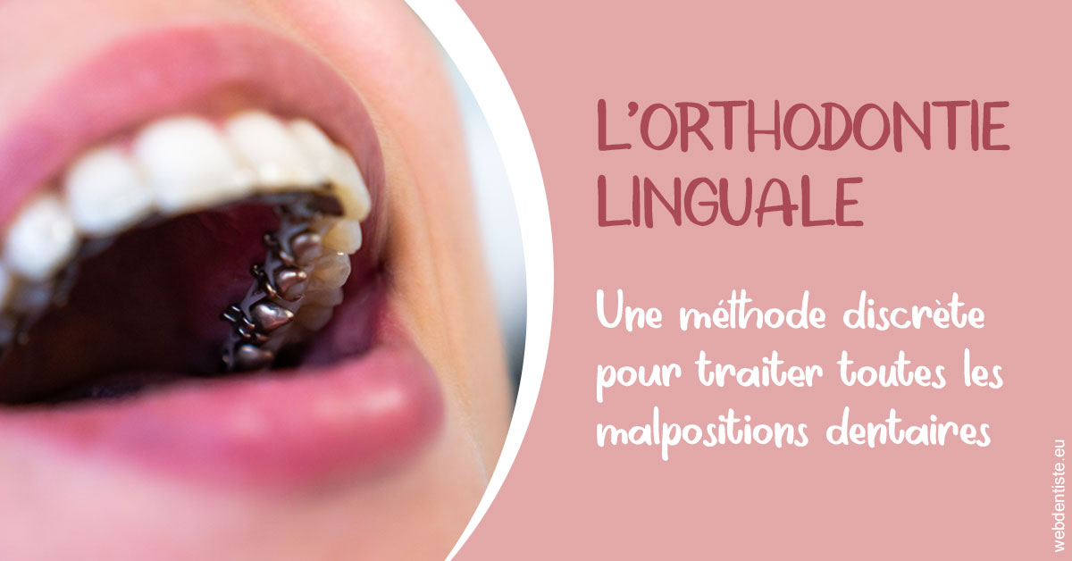 https://dr-david-mailhes.chirurgiens-dentistes.fr/L'orthodontie linguale 2