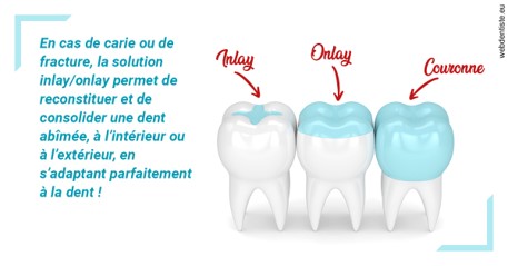 https://dr-david-mailhes.chirurgiens-dentistes.fr/L'INLAY ou l'ONLAY