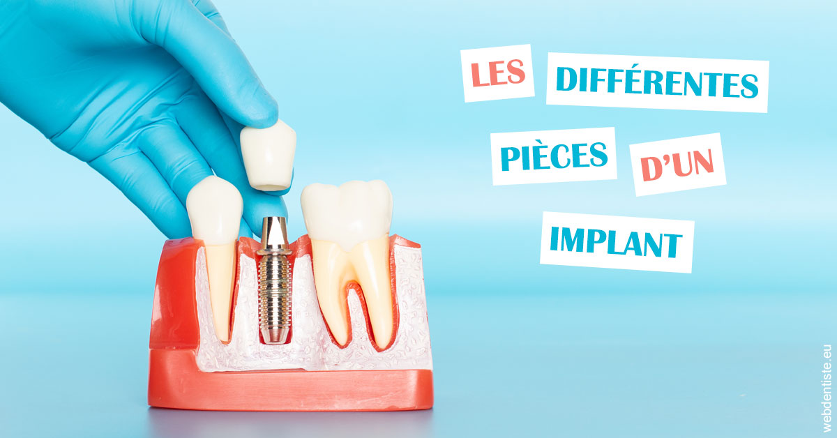 https://dr-david-mailhes.chirurgiens-dentistes.fr/Les différentes pièces d’un implant 2
