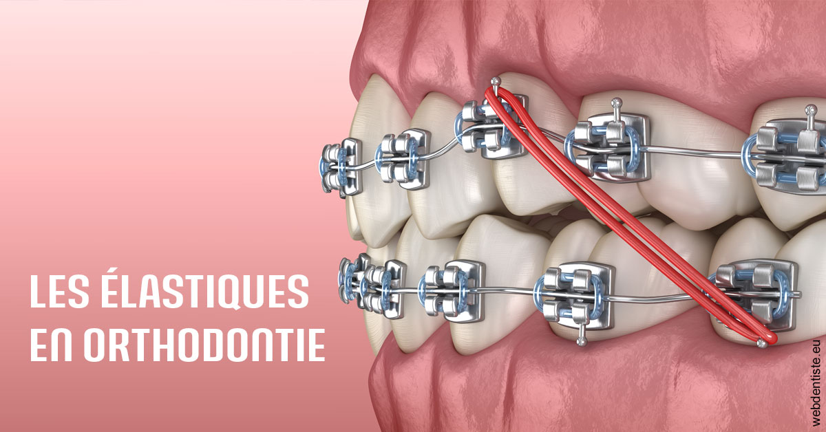 https://dr-david-mailhes.chirurgiens-dentistes.fr/Elastiques orthodontie 2