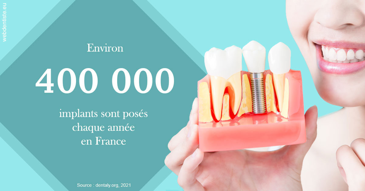 https://dr-david-mailhes.chirurgiens-dentistes.fr/Pose d'implants en France 2