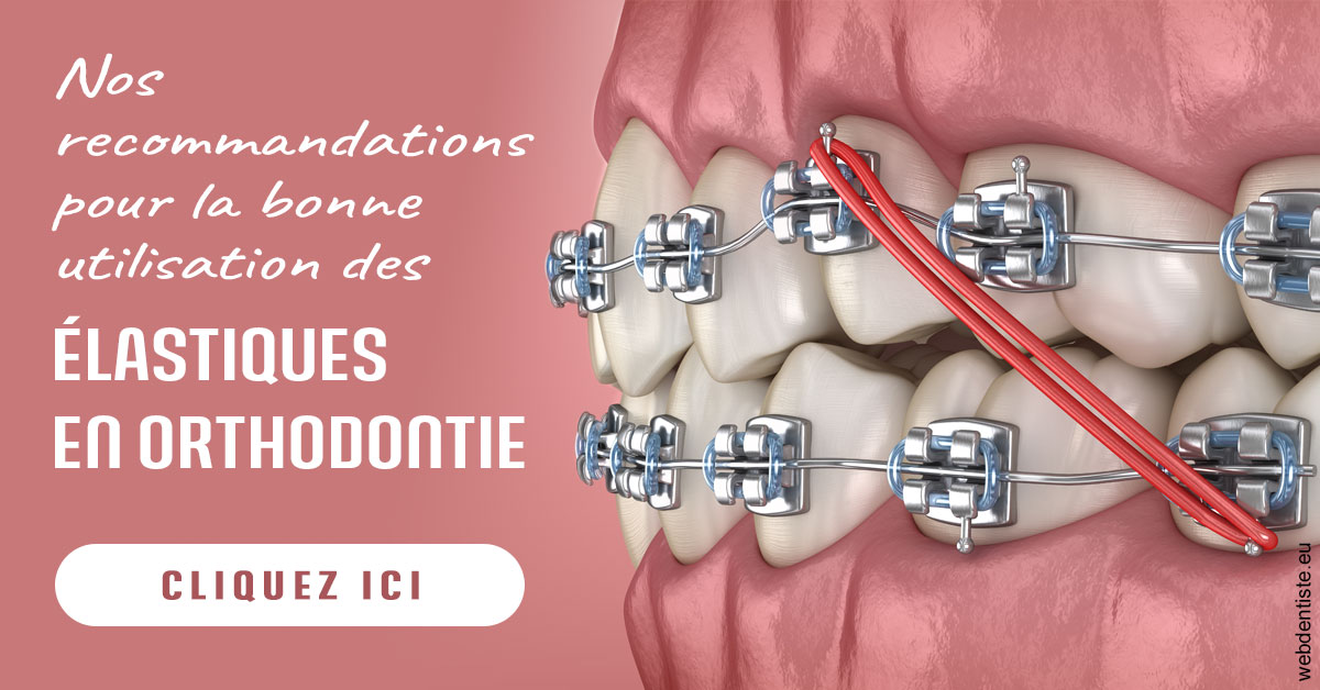 https://dr-david-mailhes.chirurgiens-dentistes.fr/Elastiques orthodontie 2